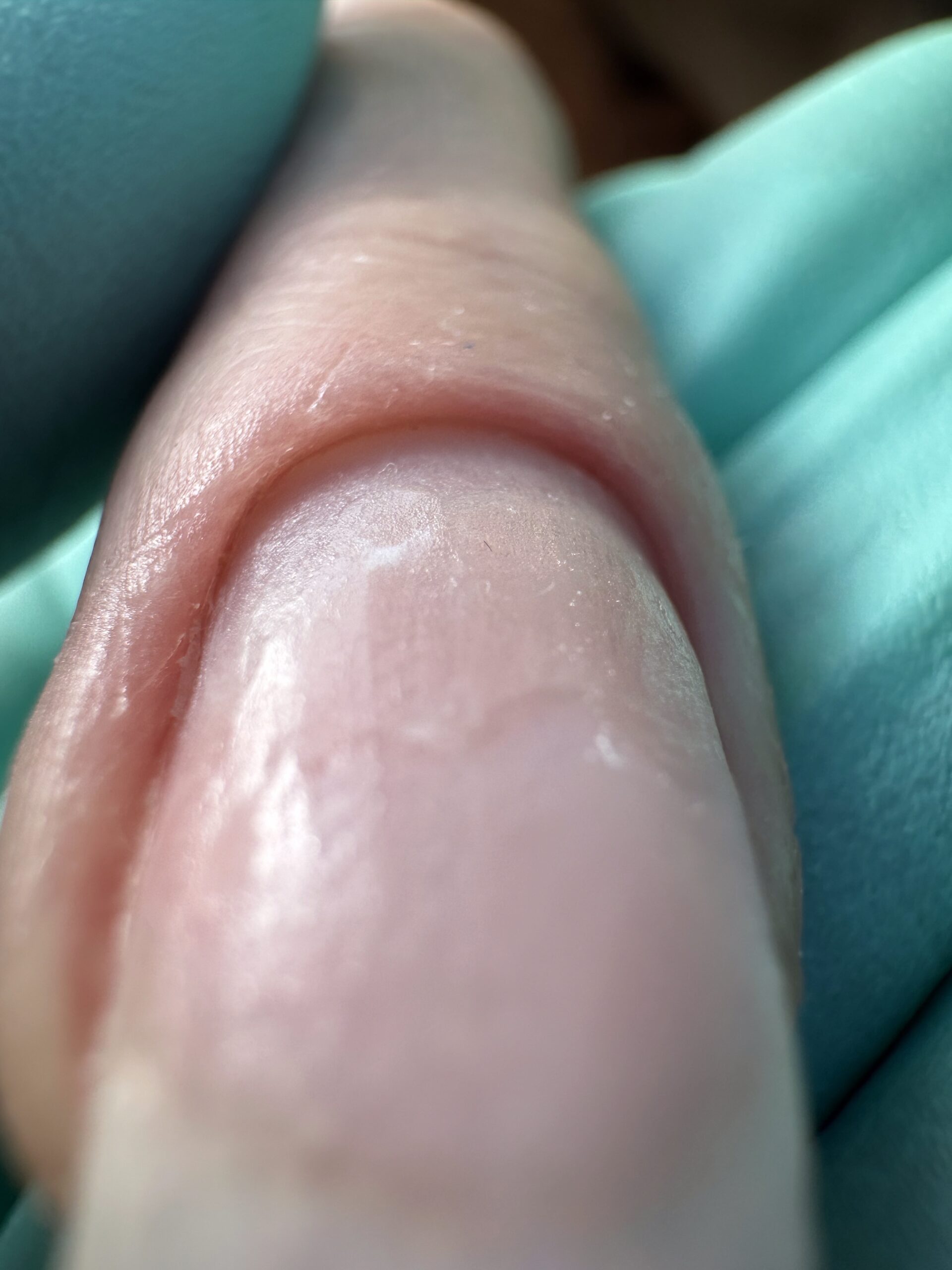 estetic 2
